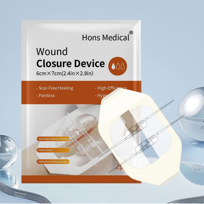 Wound closure device 2 clips