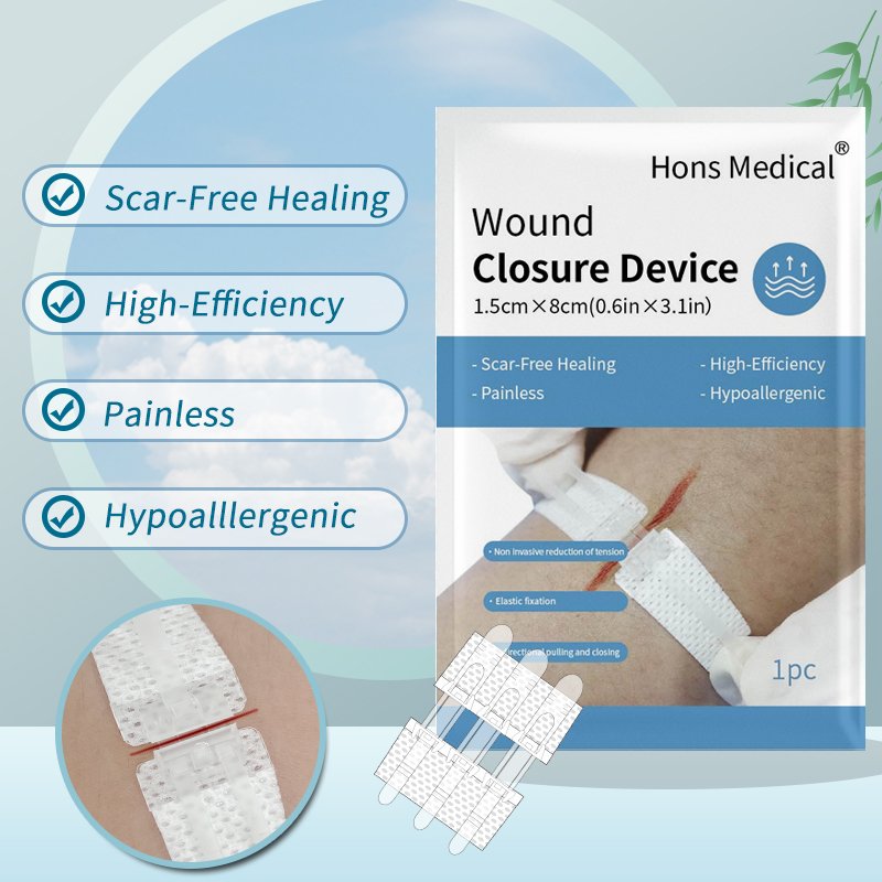 Zip line wound closure strip, Double-Side Buckle Wound Closure Device, new generation of wound closure