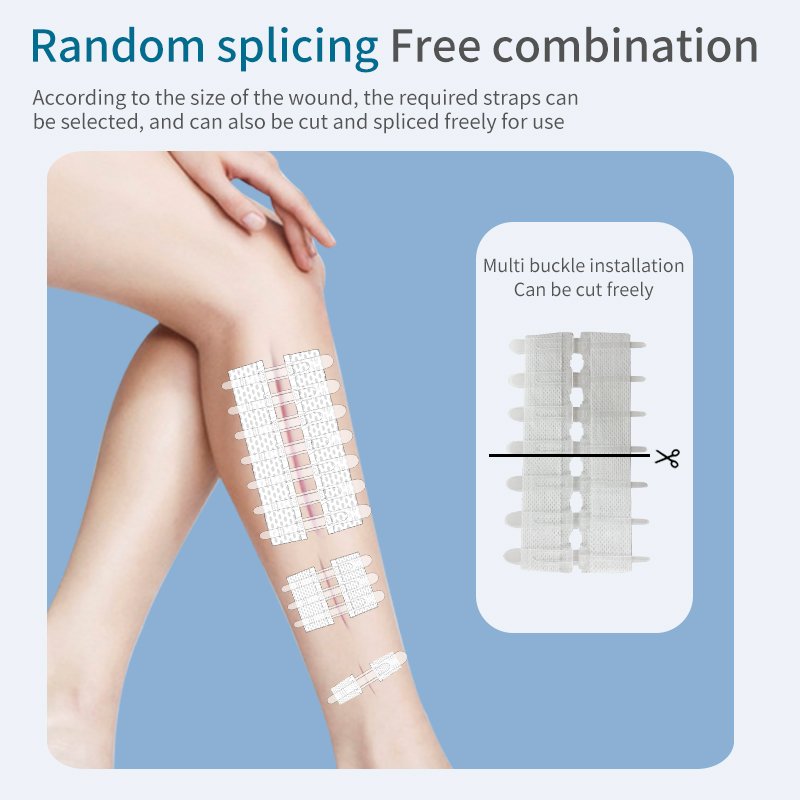 Zip line laceration non-invasive strip, Zip Stitch Suture Wound Closure Device, Non-Suture Bandage, sårlukningsanordning