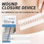 Zip Stitch Suture für Erste Hilfe, Double-Side Buckle Zipper Wound Closure Device, neue Generation von Wundverschluss für C-section (Cesarean) Wundverschluss