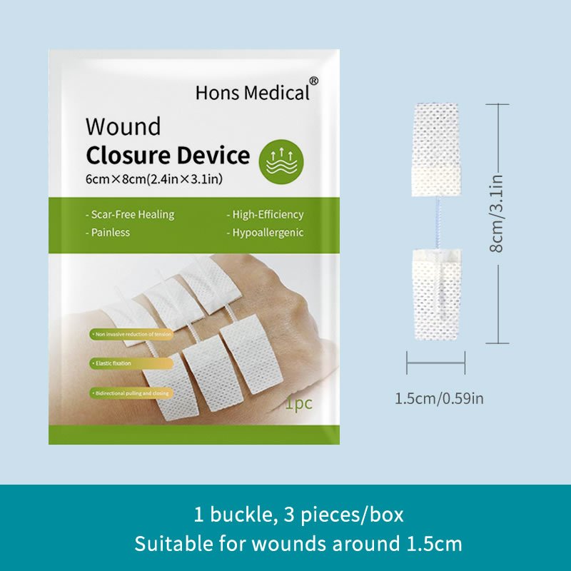 Wound closure device 1 buckle, for home first aid