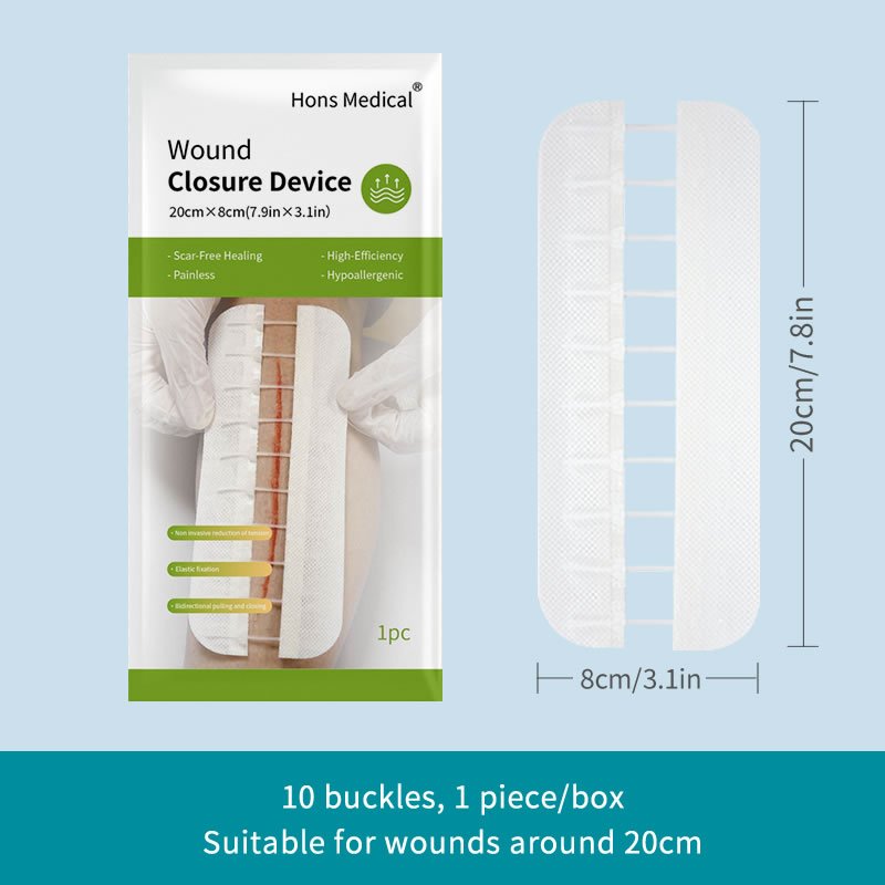 wound closure device 10 buckles, stitch free